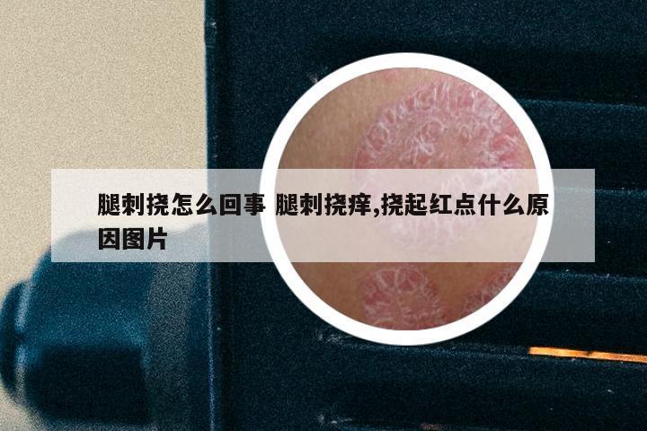 腿刺挠怎么回事 腿刺挠痒,挠起红点什么原因图片