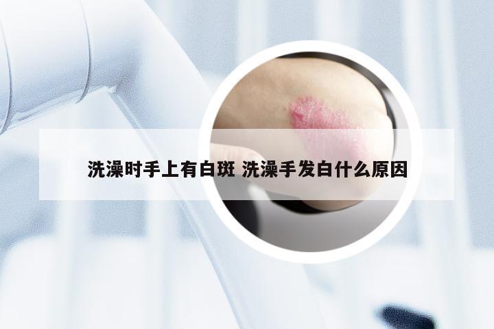 洗澡时手上有白斑 洗澡手发白什么原因