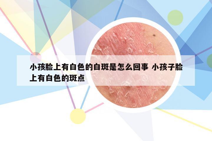 小孩脸上有白色的白斑是怎么回事 小孩子脸上有白色的斑点