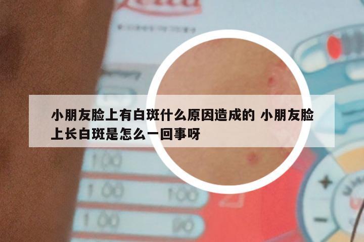 小朋友脸上有白斑什么原因造成的 小朋友脸上长白斑是怎么一回事呀