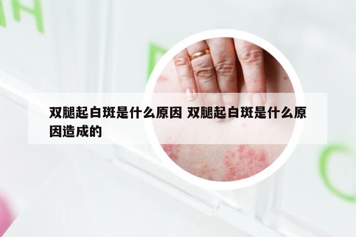 双腿起白斑是什么原因 双腿起白斑是什么原因造成的