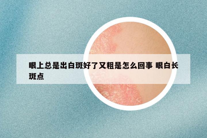 眼上总是出白斑好了又粗是怎么回事 眼白长斑点