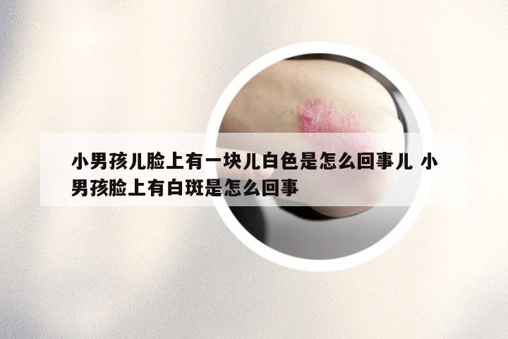 小男孩儿脸上有一块儿白色是怎么回事儿 小男孩脸上有白斑是怎么回事