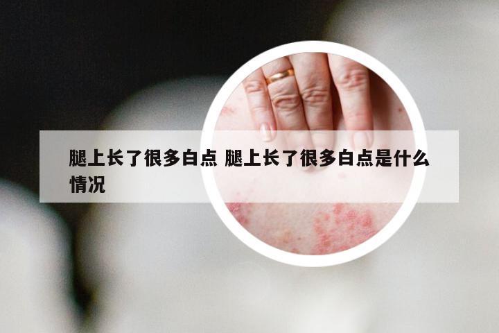 腿上长了很多白点 腿上长了很多白点是什么情况