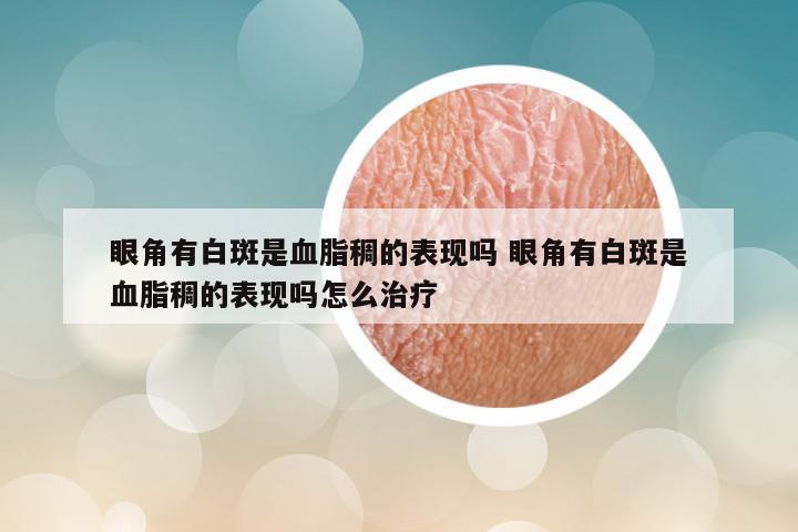 眼角有白斑是血脂稠的表现吗 眼角有白斑是血脂稠的表现吗怎么治疗