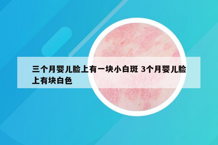 三个月婴儿脸上有一块小白斑 3个月婴儿脸上有块白色