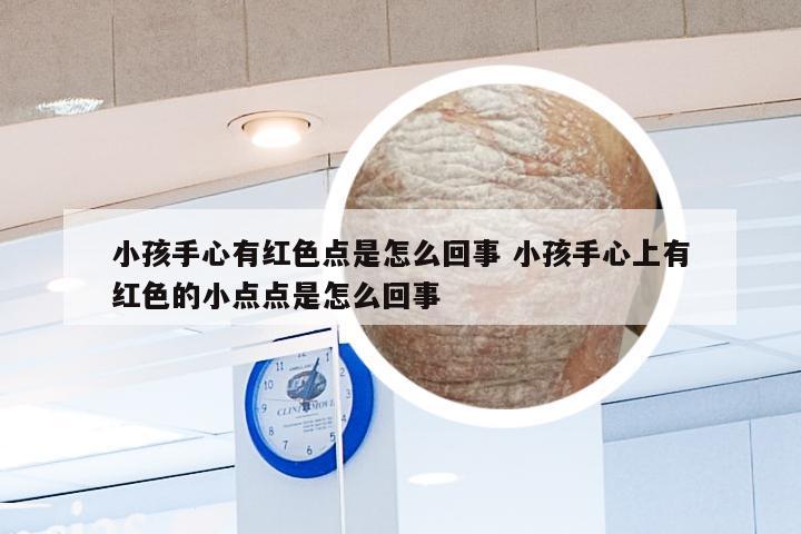 小孩手心有红色点是怎么回事 小孩手心上有红色的小点点是怎么回事