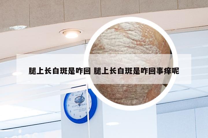 腿上长白斑是咋回 腿上长白斑是咋回事痒呢