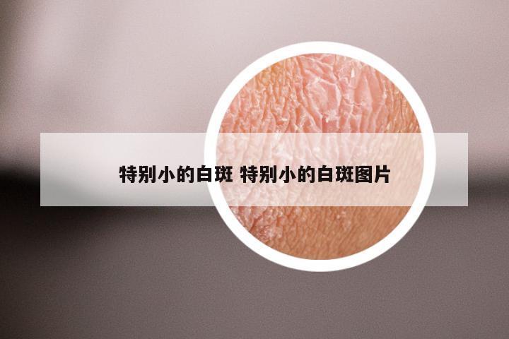 特别小的白斑 特别小的白斑图片