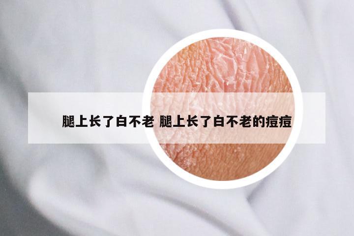 腿上长了白不老 腿上长了白不老的痘痘