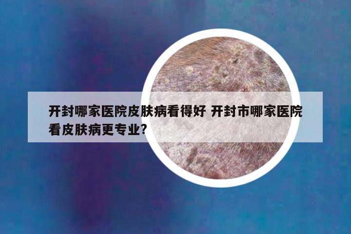 开封哪家医院皮肤病看得好 开封市哪家医院看皮肤病更专业?