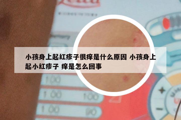 小孩身上起红疹子很痒是什么原因 小孩身上起小红疹子 痒是怎么回事