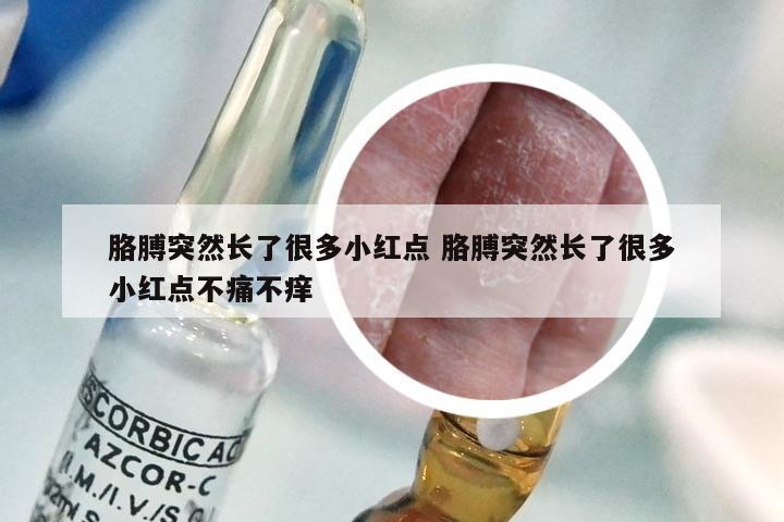 胳膊突然长了很多小红点 胳膊突然长了很多小红点不痛不痒