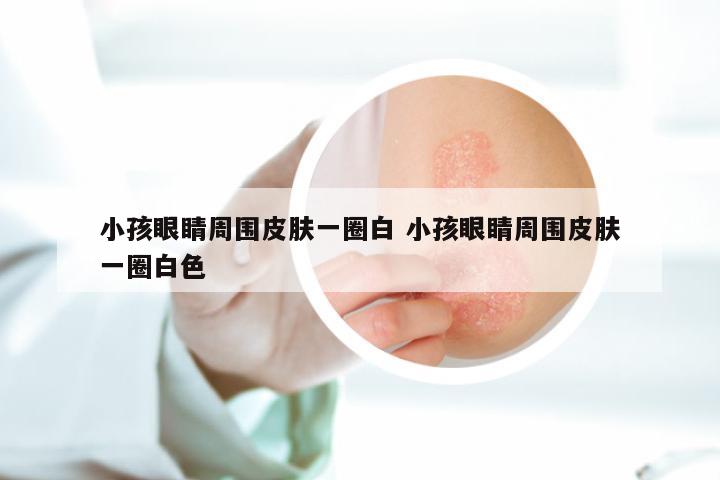 小孩眼睛周围皮肤一圈白 小孩眼睛周围皮肤一圈白色
