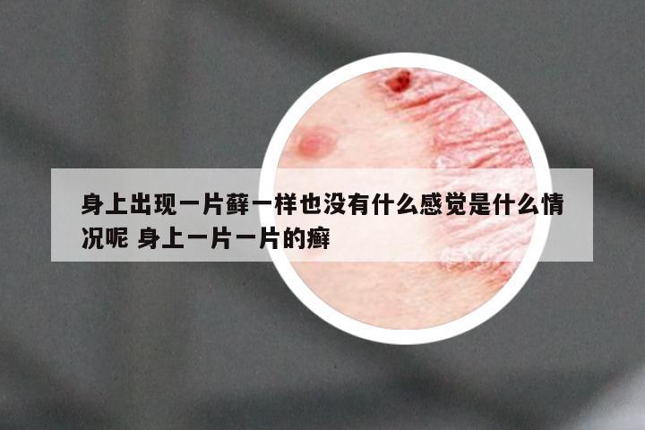 身上出现一片藓一样也没有什么感觉是什么情况呢 身上一片一片的癣