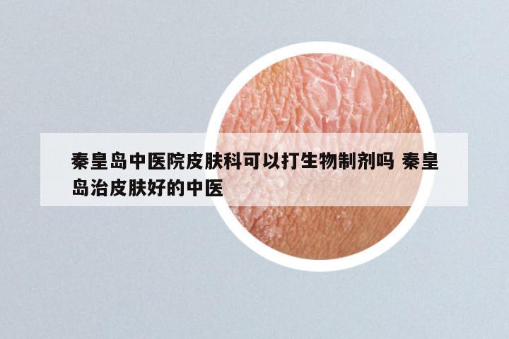 秦皇岛中医院皮肤科可以打生物制剂吗 秦皇岛治皮肤好的中医