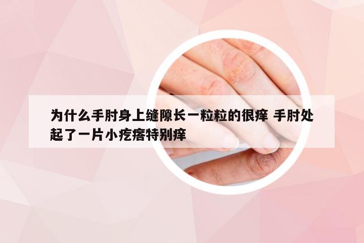 为什么手肘身上缝隙长一粒粒的很痒 手肘处起了一片小疙瘩特别痒