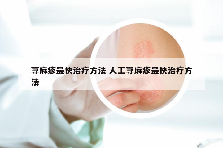 荨麻疹最快治疗方法 人工荨麻疹最快治疗方法