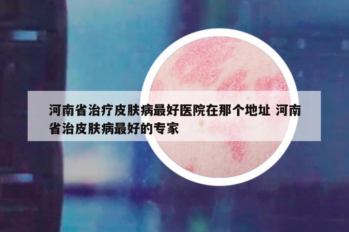 河南省治疗皮肤病最好医院在那个地址 河南省治皮肤病最好的专家