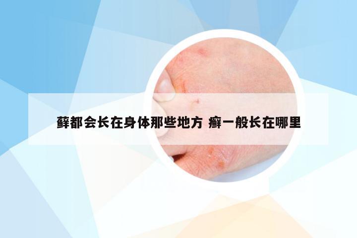 藓都会长在身体那些地方 癣一般长在哪里