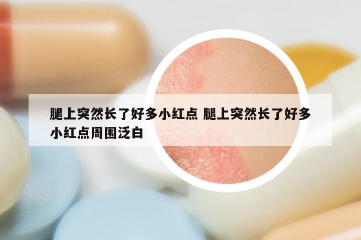 腿上突然长了好多小红点 腿上突然长了好多小红点周围泛白