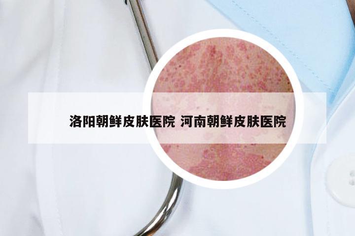 洛阳朝鲜皮肤医院 河南朝鲜皮肤医院
