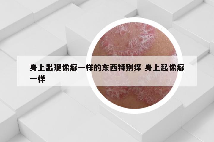 身上出现像癣一样的东西特别痒 身上起像癣一样