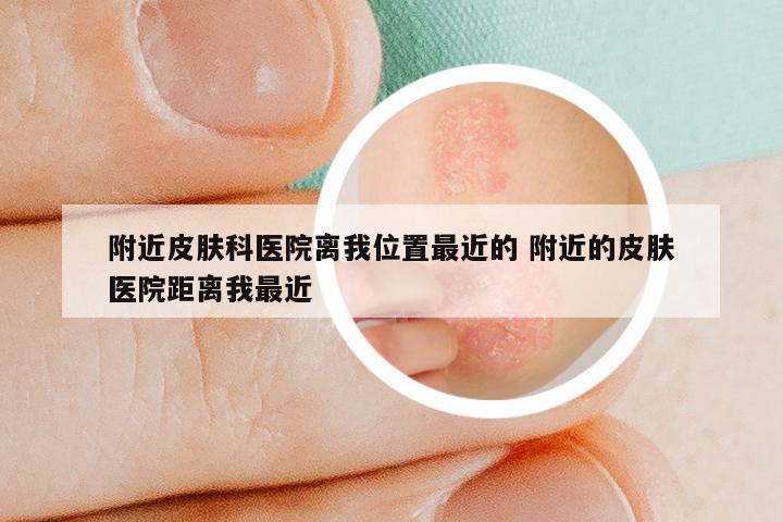 附近皮肤科医院离我位置最近的 附近的皮肤医院距离我最近