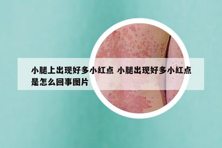 小腿上出现好多小红点 小腿出现好多小红点是怎么回事图片