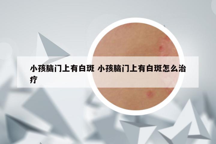 小孩脑门上有白斑 小孩脑门上有白斑怎么治疗