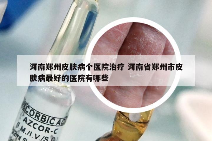 河南郑州皮肤病个医院治疗 河南省郑州市皮肤病最好的医院有哪些