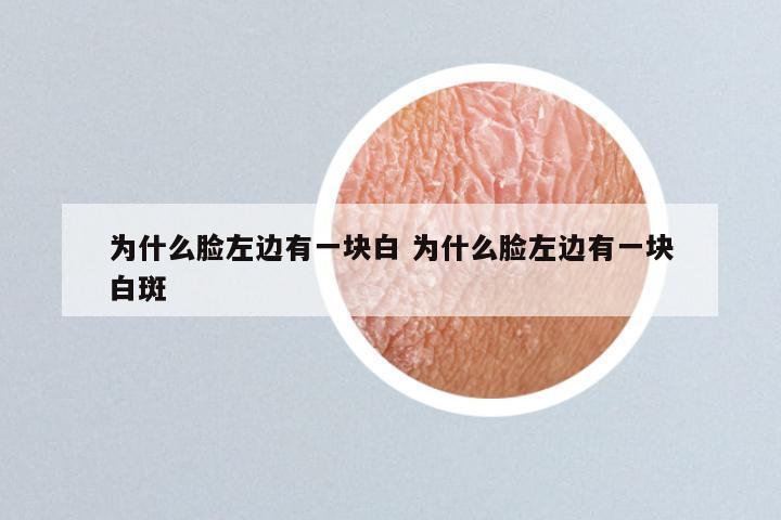 为什么脸左边有一块白 为什么脸左边有一块白斑