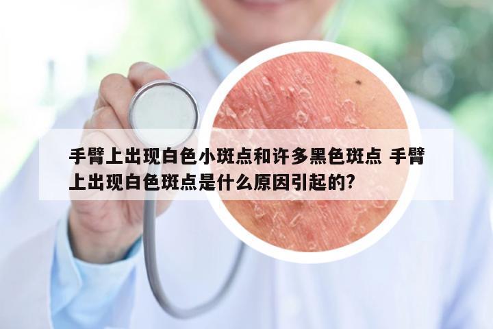 手臂上出现白色小斑点和许多黑色斑点 手臂上出现白色斑点是什么原因引起的?