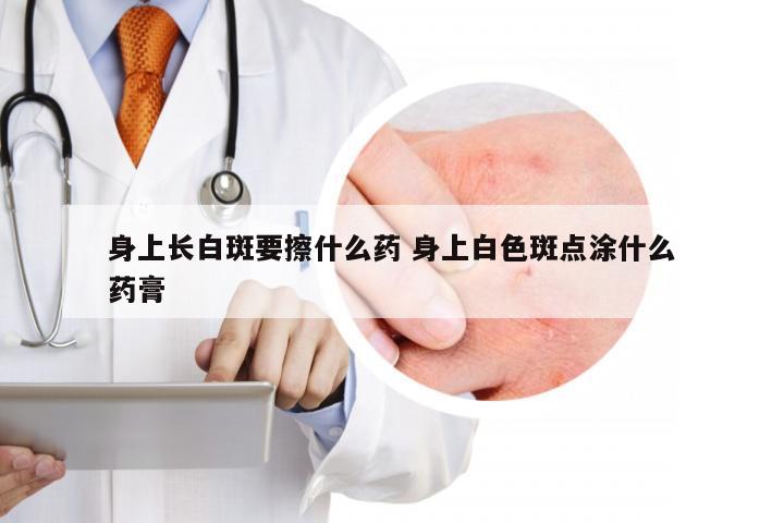身上长白斑要擦什么药 身上白色斑点涂什么药膏