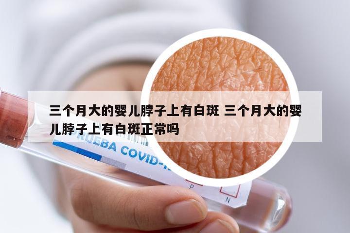 三个月大的婴儿脖子上有白斑 三个月大的婴儿脖子上有白斑正常吗