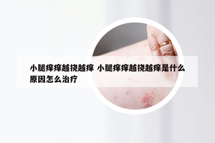 小腿痒痒越挠越痒 小腿痒痒越挠越痒是什么原因怎么治疗