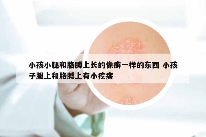 小孩小腿和胳膊上长的像癣一样的东西 小孩子腿上和胳膊上有小疙瘩