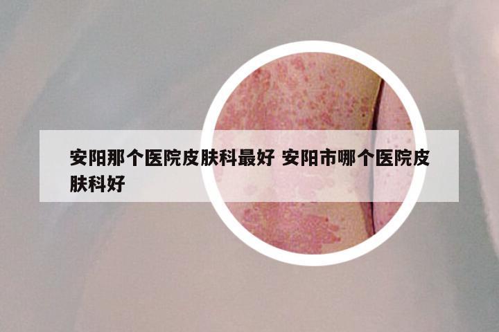 安阳那个医院皮肤科最好 安阳市哪个医院皮肤科好