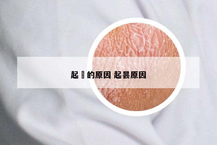 起廯的原因 起昙原因