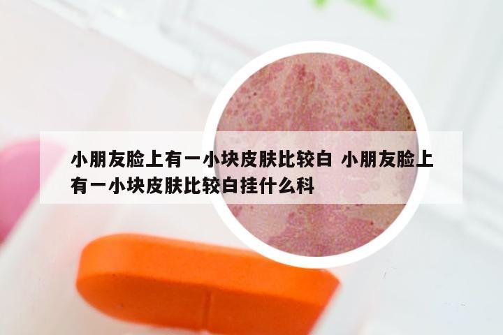 小朋友脸上有一小块皮肤比较白 小朋友脸上有一小块皮肤比较白挂什么科