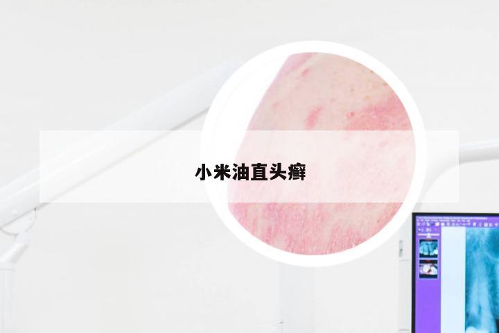 小米油直头癣