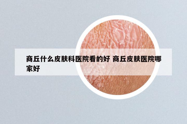 商丘什么皮肤科医院看的好 商丘皮肤医院哪家好