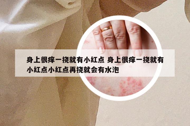 身上很痒一挠就有小红点 身上很痒一挠就有小红点小红点再挠就会有水泡