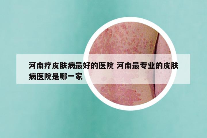 河南疗皮肤病最好的医院 河南最专业的皮肤病医院是哪一家