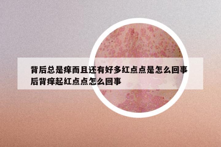背后总是痒而且还有好多红点点是怎么回事 后背痒起红点点怎么回事