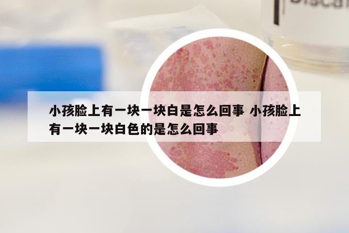 小孩脸上有一块一块白是怎么回事 小孩脸上有一块一块白色的是怎么回事