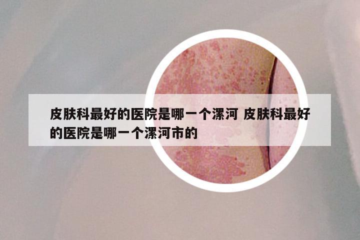 皮肤科最好的医院是哪一个漯河 皮肤科最好的医院是哪一个漯河市的