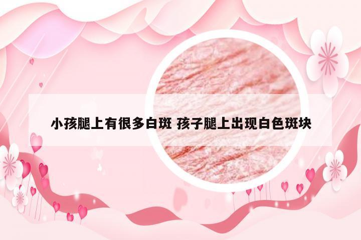 小孩腿上有很多白斑 孩子腿上出现白色斑块