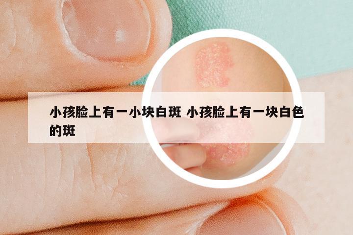 小孩脸上有一小块白斑 小孩脸上有一块白色的斑