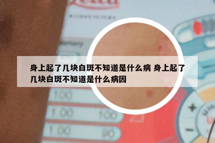 身上起了几块白斑不知道是什么病 身上起了几块白斑不知道是什么病因